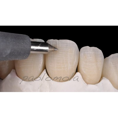 Surface Texture Tool (STT) - HAND TOOL FOR SURFACE TEXTURE