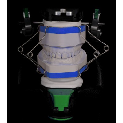 3S Model Springs - SPRINGS FOR LOCKING MODELS / IMPRESSIONS ON SCANNER