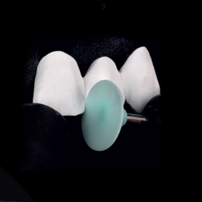 Grommet PANTHER Green - GROMMET FOR PRESINTERED ZIRCONIUM