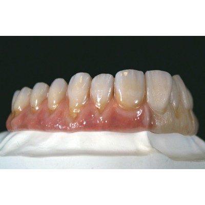 White Kit WOHLWEND Vision 3D ARTISTIC - LIQUID CERAMIC