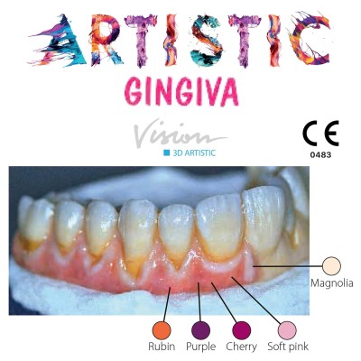 Gingiva Kit WOHLWEND Vision 3D ARTISTIC - LIQUID CERAMIC
