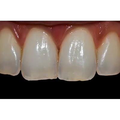 30 led illuminator - LED RING FOR SMARTPHONE