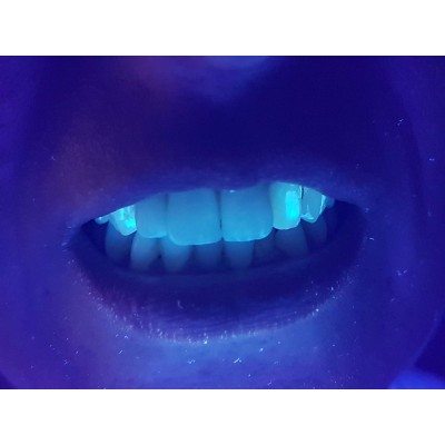 Wood Lamp - UV LED Flashlight