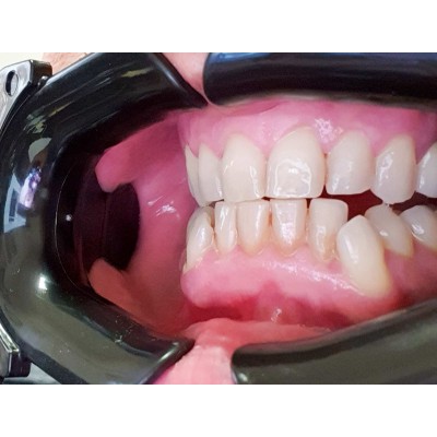 Set of 2 black mouth openers "C Shape" 2 pcs - MOUTH OPENER FOR PHOTOGRAPHY