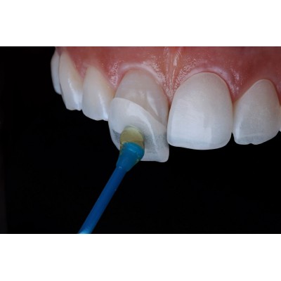 Take Stick - ADHESIVE APPLICATOR FOR VENEERS / CROWNS / INLAYS