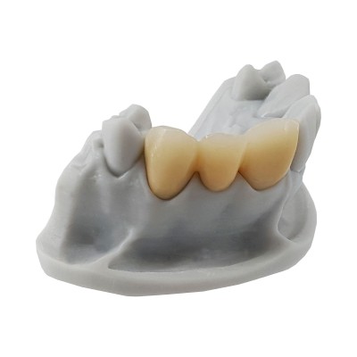 BIOK-3D C&B A2 for Castable Temporaries - 3D PRINTING RESIN FOR TEMPORARIES (Castable)