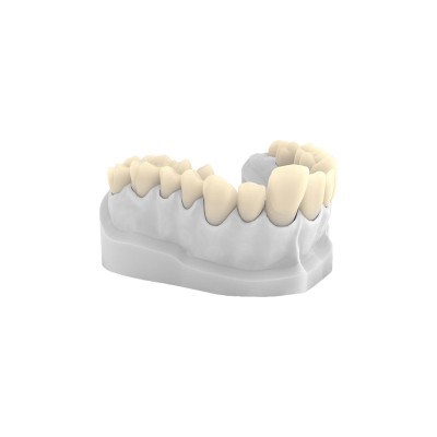 3s dental Easy Model 8K - 1 kg - 3D PRINTING RESIN FOR DENTAL MODELS