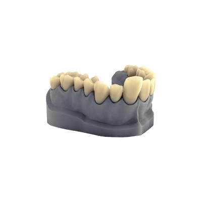 3s dental Easy Model 8K - 1 kg - 3D PRINTING RESIN FOR DENTAL MODELS