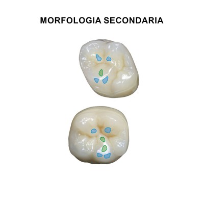 Gebdi Tribos 501 Posterior - PMMA teeth 3 layers