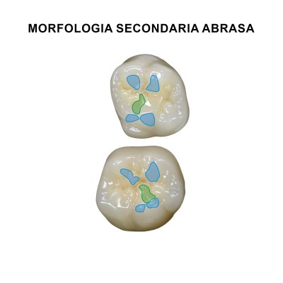 Gebdi Tribos 501 c Posterior - composite teeth