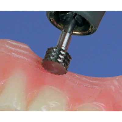 Repair/retention cutter