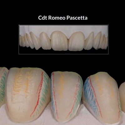 Lead 20pcs - Nano Dia Color Mix 0,5 - ASSORTED COLORED LEADS