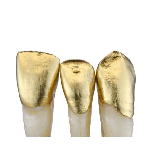 3S Vision Tex 2.0 Oro 10ml...