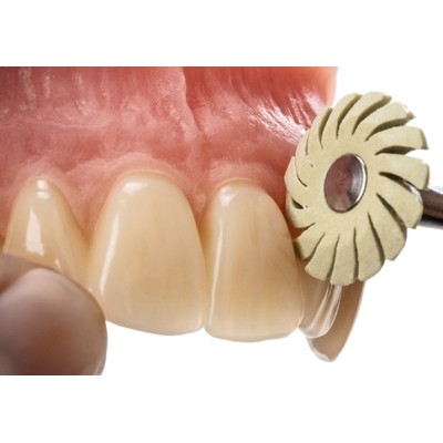 Spiral wheel 160 PANTHER Polymer - RUBBER FOR RESIN FINISHING AND POLISHING