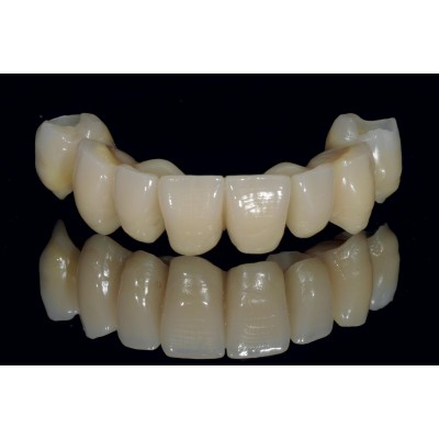 Gold Temp Implants Smalti - LONG-LASTING MICROFILLED TEMPORARY RESIN