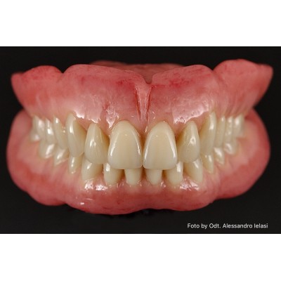 3S Final Spray Plus - FINALIZER FOR PROSTHESIS SPRAY