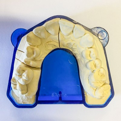 Base for iDente models 25 pcs